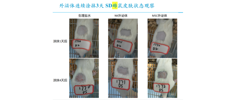 Exclusive Research Data from Cell Valley: NK Exosomes Demonstrate Superior Skin Repair Potential, Poised to Become a Future Breakthrough in Skin Repair and Anti-Aging